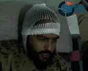 Abdullah al Muhaysini Injured by Russian Airstrike in Lattakia