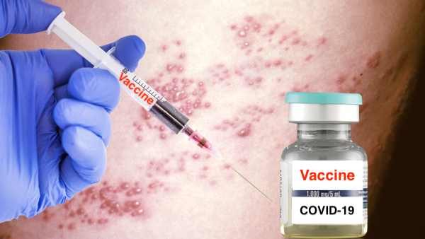 Herpes zoster vaccine syringe dispatch